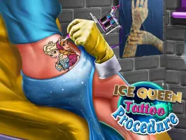 Ice Queen Tattoo Procedure